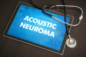 Acoustic Neuroma