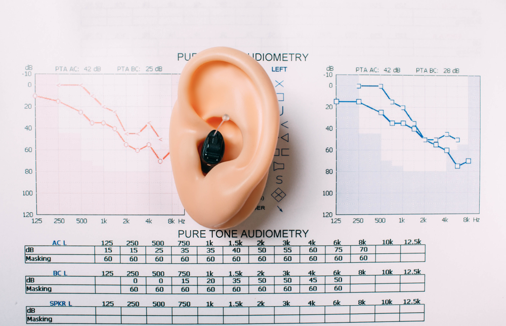 understanding your audiogram